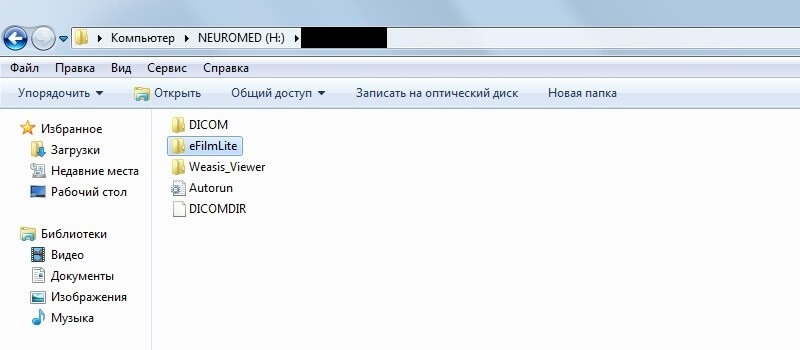 Efilm lite как извлечь снимки